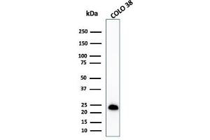 Western Blot Analysis of COLO-38 cell lysate using MART-1 Rabbit Recombinant Monoclonal Antibody (MLANA/1409R). (Rekombinanter MLANA Antikörper)