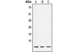 Western blot analysis of LSM2 expression in HEK293T (A), NIH3T3 (B), PC12 (C) whole cell lysates. (LSM2 Antikörper  (Center))