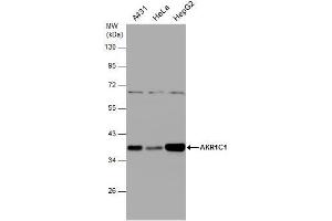 WB Image Various whole cell extracts (30 μg) were separated by 10% SDS-PAGE, and the membrane was blotted with AKR1C1 antibody , diluted at 1:1000. (AKR1C1 Antikörper)