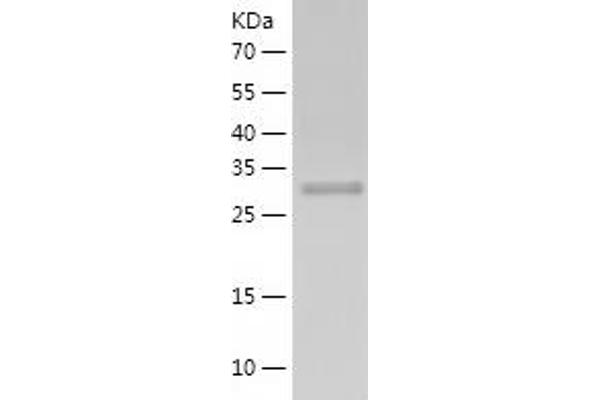 AIP Protein (AA 1-330) (His tag)