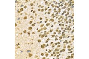 Immunohistochemistry (Paraffin-embedded Sections) (IHC (p)) image for anti-Heterogeneous Nuclear Ribonucleoprotein A2/B1 (HNRNPA2B1) (AA 1-180) antibody (ABIN3021593)