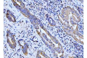 IHC analysis of BCKDK using anti-BCKDK antibody (ABIN7601470). (BCKDK Antikörper  (AA 36-316))