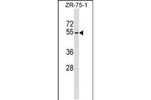 Western blot analysis in ZR-75-1 cell line lysates (35ug/lane). (Phospholipase D4 Antikörper  (N-Term))