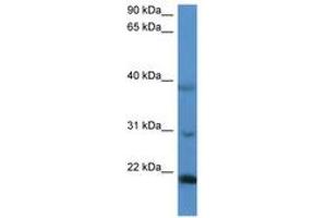 Image no. 1 for anti-Inner Mitochondrial Membrane Peptidase Subunit 2 (IMMP2L) (AA 48-97) antibody (ABIN6746852) (IMMP2L Antikörper  (AA 48-97))