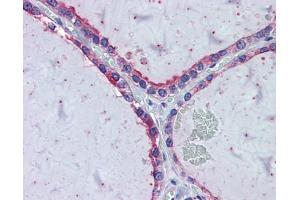 Immunohistochemistry with HeLa, Vera, HeLa transfected with mouse construct tissue (KIF20A Antikörper  (Middle Region))