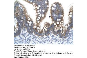 Human Intestine (TFB2M Antikörper  (N-Term))