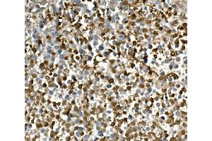 IHC analysis of HGS using anti-HGS antibody (ABIN7601205). (HGS Antikörper  (AA 3-777))