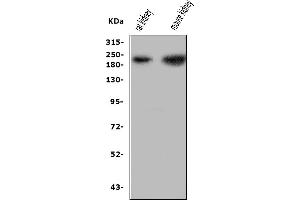 Western blot analysis of Nephrin using anti-Nephrin antibody (ABIN5518783).