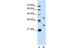 ST8SIA2 antibody used at 1 ug/ml to detect target protein. (ST8SIA2 Antikörper  (C-Term))