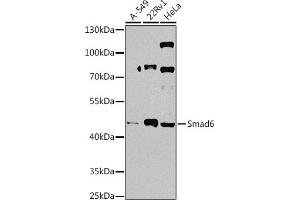 Western blot analysis of extracts of various cell lines, using Smad6 antibody (ABIN7270355) at 1:1000 dilution. (SMAD6 Antikörper  (AA 257-496))
