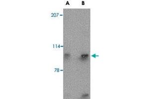 Western blot analysis of SLITRK4 in mouse brain tissue lysate with SLITRK4 polyclonal antibody  at (A) 0. (SLITRK4 Antikörper  (N-Term))