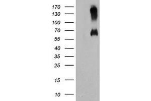 Western Blotting (WB) image for anti-Chromosome 18 Open Reading Frame 8 (C18orf8) antibody (ABIN1497027) (C18orf8 Antikörper)