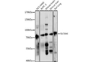Western blot analysis of extracts of various cell lines, using SLC6 antibody (ABIN7270739) at 1:1000 dilution. (TAUT Antikörper  (AA 250-320))