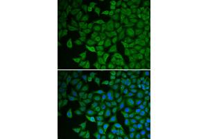 Immunofluorescence analysis of HeLa cells using CHEK2 antibody. (CHEK2 Antikörper)