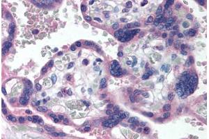 Human Placenta (formalin-fixed, paraffin-embedded) stained with TP73 antibody ABIN290399 at 5 ug/ml followed by biotinylated anti-mouse IgG secondary antibody ABIN481714, alkaline phosphatase-streptavidin and chromogen. (Tumor Protein p73 Antikörper  (AA 2-13))