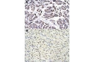 Immunohistochemical staining (Formalin-fixed paraffin-embedded sections) of human muscle (A) and human heart (B) with GTF2H3 polyclonal antibody  at 4-8 ug/mL working concentration. (GTF2H3 Antikörper  (N-Term))