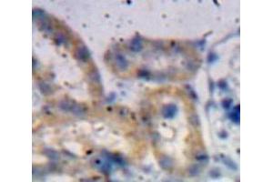 Immunohistochemistry (IHC) image for anti-ADAM Metallopeptidase with Thrombospondin Type 1 Motif, 1 (ADAMTS1) (AA 855-968) antibody (ABIN1857899)