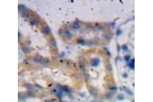 Used in DAB staining on fromalin fixed paraffin-embedded Kidney tissue (ADAMTS1 Antikörper  (AA 855-968))
