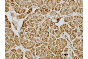 Immunoperoxidase of monoclonal antibody to CENPJ on formalin-fixed paraffin-embedded human pancreas. (CENPJ Antikörper  (AA 979-1088))