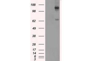 Image no. 2 for anti-L1 Cell Adhesion Molecule (L1CAM) antibody (ABIN1499088)