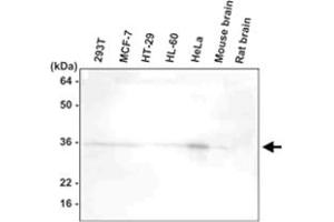 Western blot analysis of 293T , MCF - 7 , HT - 29 , HL - 60 , HeLa , mouse brain , and rat brain extracts were resolved by SDS - PAGE , transferred to PVDF membrane and probed with HTRA2 monoclonal antibody , clone 1B3 (1 : 1000)  . (HTRA2 Antikörper  (AA 134-458))