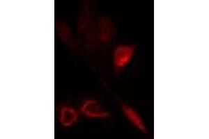 ABIN6275795 staining  HeLa cells by IF/ICC. (ANAPC5 Antikörper  (Internal Region))