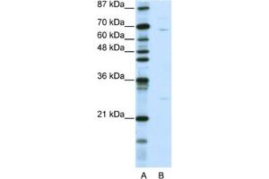 Western Blotting (WB) image for anti-Kelch-Like 13 (KLHL13) antibody (ABIN2461016)