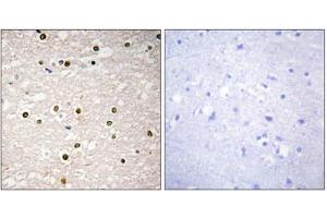 Immunohistochemistry analysis of paraffin-embedded human brain tissue, using p73 antibody. (Tumor Protein p73 Antikörper  (Internal Region))