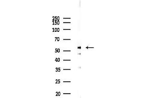 anti-Cyclin-Dependent Kinase 19 (CDK19) (C-Term) antibody