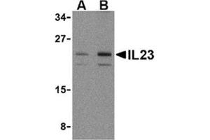 Image no. 1 for anti-Interleukin 23, alpha subunit p19 (IL23A) (N-Term) antibody (ABIN318745) (IL23A Antikörper  (N-Term))