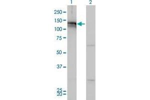 Lane 1: AXL transfected lysate ( 98 KDa). (AXL HEK293 Cell Transient Overexpression Lysate(Non-Denatured))
