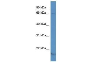 Western Blot showing KCNA5 antibody used at a concentration of 1.