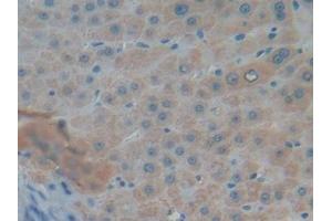 Immunohistochemistry (IHC) image for anti-Mucin 5AC, Oligomeric Mucus/gel-Forming (MUC5AC) antibody (ABIN7429022)