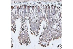 IHC analysis of CALR using anti-CALR antibody (ABIN7600329).