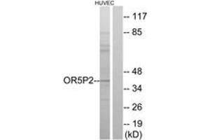 Western Blotting (WB) image for anti-Olfactory Receptor, Family 5, Subfamily P, Member 2 (OR5P2) (AA 193-242) antibody (ABIN2891034) (OR5P2 Antikörper  (AA 193-242))