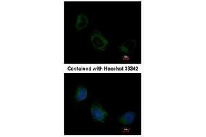 ICC/IF Image Immunofluorescence analysis of methanol-fixed HeLa, using EIF3F, antibody at 1:200 dilution.