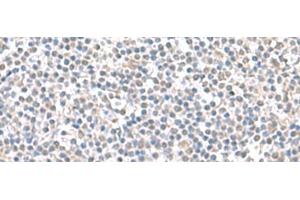 Immunohistochemistry of paraffin-embedded Human tonsil tissue using IFI27 Polyclonal Antibody at dilution of 1:100(x200) (IFI27 Antikörper)