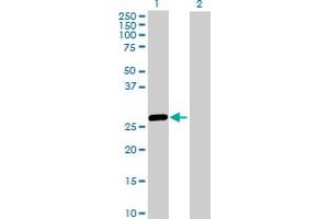 Western Blotting (WB) image for anti-Major Histocompatibility Complex, Class II, DR beta 5 (HLA-DRB5) (AA 1-266) antibody (ABIN516519)