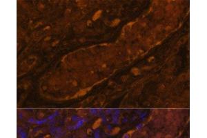 Immunofluorescence analysis of Human placenta using CFI Polyclonal Antibody at dilution of 1:100. (Complement Factor I Antikörper)