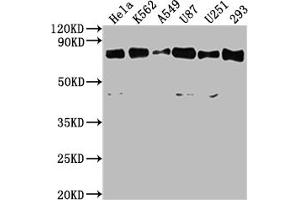 Western Blot Positive WB detected in: Hela whole cell lysate, K562 whole cell lysate, A549 whole cell lysate, U87 whole cell lysate, U251 whole cell lysate, 293 whole cell lysate All lanes: SNX9 antibody at 1:2000 Secondary Goat polyclonal to rabbit IgG at 1/50000 dilution Predicted band size: 67 kDa Observed band size: 67 kDa (SNX9 Antikörper  (AA 85-200))