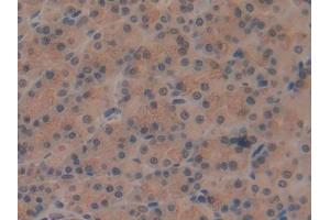 DAB staining on IHC-P; Samples: Rat Stomach Tissue (ATP6AP2 Antikörper  (AA 18-302))