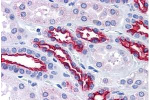 Kidney, Human: Formalin-Fixed, Paraffin-Embedded (FFPE) (MUC1 Antikörper)