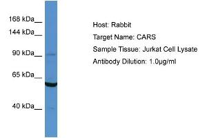 Host: Rabbit Target Name: CARS Sample Type: Jurkat Whole cell lysates Antibody Dilution: 1.