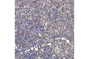 IHC analysis of SARS2 using anti-SARS2 antibody (ABIN7601804).