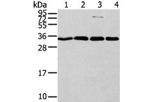 Western Blot analysis of Hela, Jurkat, 293T and lovo cell using CBX7 Polyclonal Antibody at dilution of 1/200 (CBX7 Antikörper)