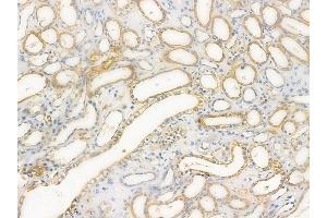 ABIN6259358 and ABIN6276076 at 1/100 staining human normal kidney tissue by IHC-P.