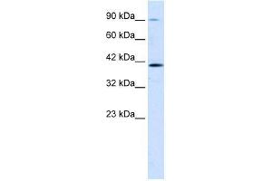 Human Jurkat; WB Suggested Anti-CCDC16 Antibody Titration: 1. (CCDC16 Antikörper  (Middle Region))