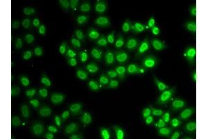 Immunofluorescence (IF) image for anti-Ewing Sarcoma Breakpoint Region 1 (EWSR1) antibody (ABIN1882293) (EWSR1 Antikörper)