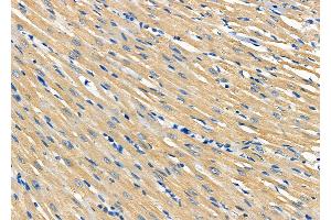 ABIN6264310 and ABIN6277668 at 1/100 staining Rat heart tissue by IHC-P.