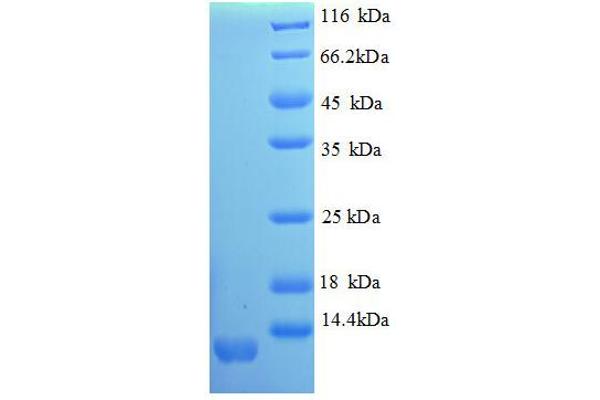 CXCL11 Protein (AA 22-98, partial) (His tag)